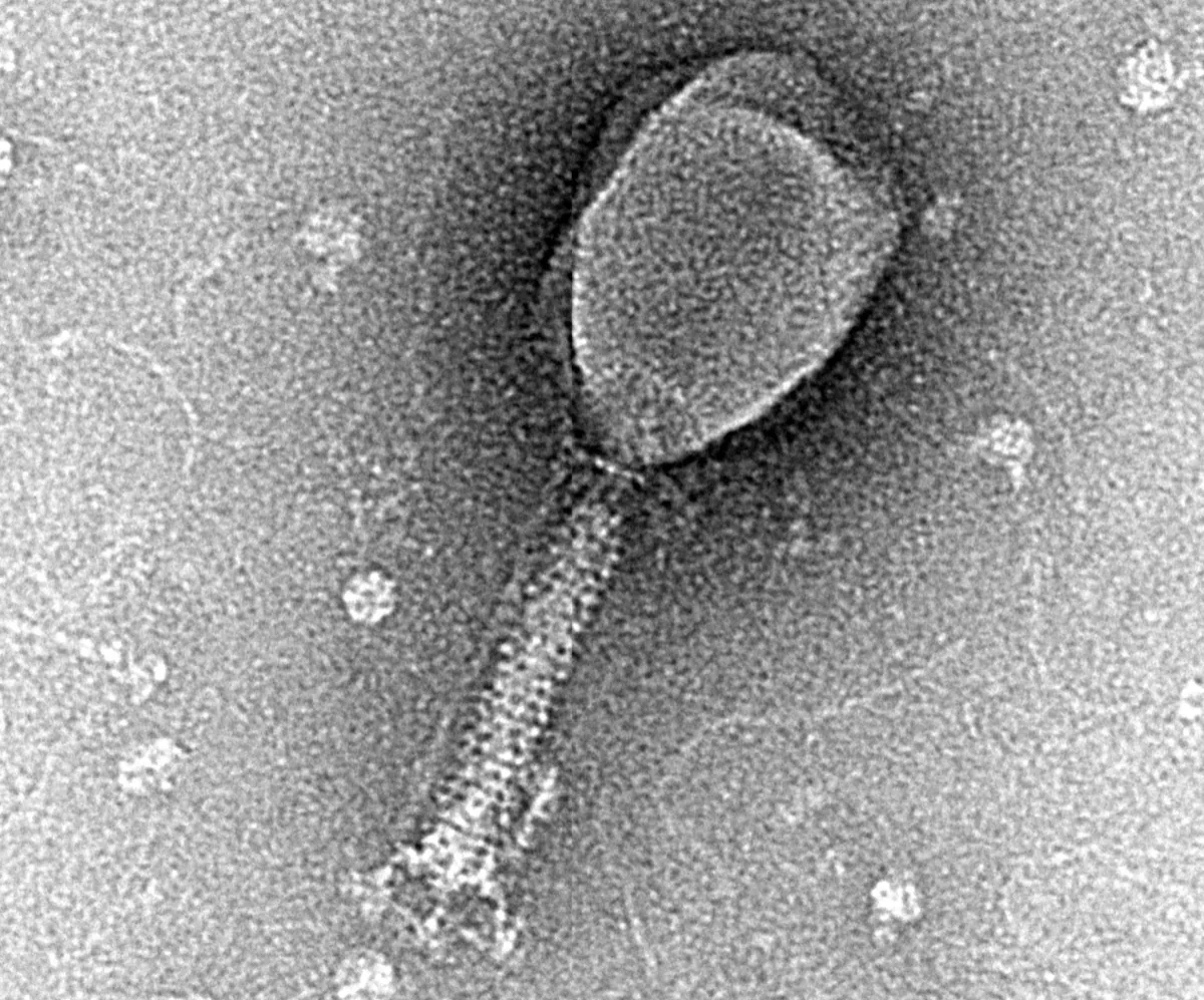 Transmission electron micrograph of a single T2 bacteriophage, with a rounded head on top of a long striped tail